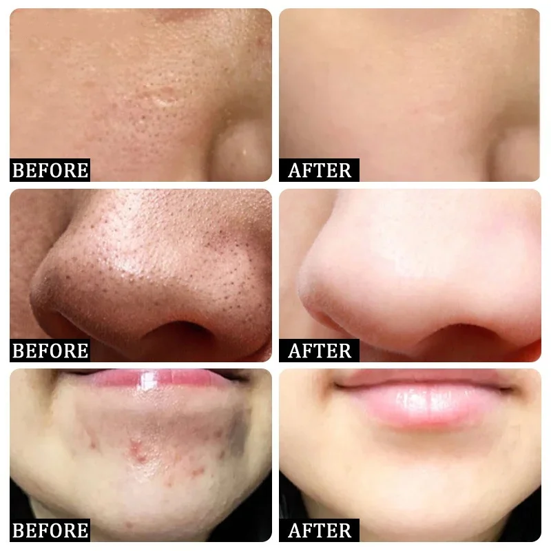 Salicylic Acid Pore Clearing C - Korean Skincare Routine ulasan dan harga